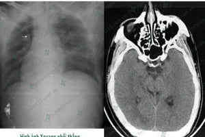 Tài xế hôn mê sâu khi lái xe chỉ vì quên ăn sáng