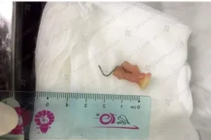 Sặc... răng giả khi đang chạy xe máy