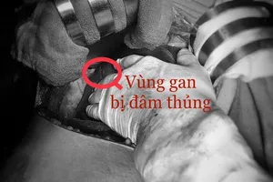 Bị đâm suýt chết vì tranh cãi bà Táo thương ông Táo nào nhất