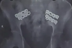 Người nhà đòi chuyển nạn nhân, BV giữ lại cứu sống