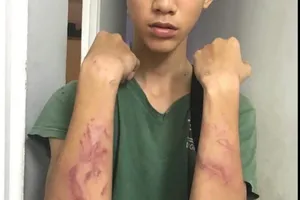 Đề xuất phạt tiền cha dượng đánh con riêng của vợ