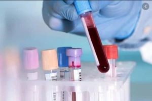 BV Nhi đồng 1 được phép xét nghiệm COVID-19