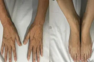 Tưởng thay đổi tướng mạo, té ra mắc bệnh to đầu chi