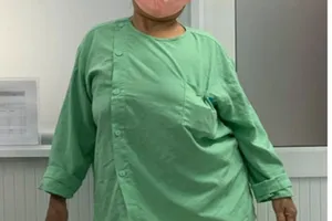 'Giải cứu' bệnh nhân không đi được 100 m do còng vẹo cột sống