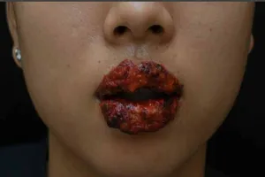 Suýt mất cặp môi sau khi xăm
