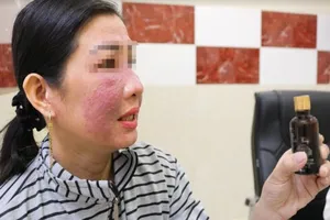 Mặt nham nhở do bôi mỹ phẩm 'trời ơi đất hỡi'