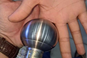 Ngón tay trỏ trẻ 12 tuổi kẹt trong ổ khóa xoay