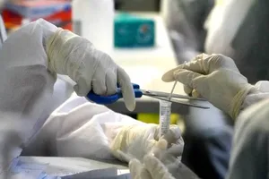 Bình Tân cách ly tạm thời UBND phường An Lạc do liên quan ca bệnh COVID-19