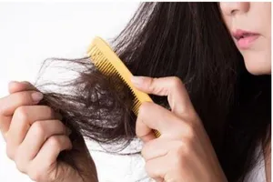 Tóc rụng nhiều sau khi điều trị khỏi COVID-19