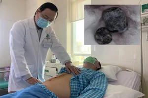 Đau bụng dữ dội, phải cấp cứu vì không đi khám sớm dấu hiệu này