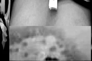 Tan giấc mộng làm đẹp sau khi đi spa làm hồng nhũ hoa