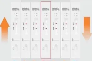 Xác virus SARS-CoV-2 tồn tại trong cơ thể bao lâu sau khi F0 hết bệnh?