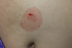 Bé gái 10 tuổi mắc căn bệnh hiếm gặp, 25 năm qua chỉ có 25 ca