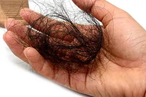 Có đúng tiêm vaccine COVID-19 làm rụng tóc?