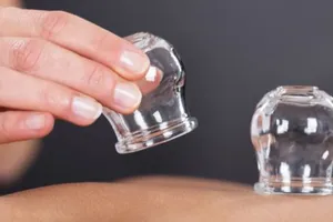 Giác hơi, cạo gió có trị được cảm lạnh?