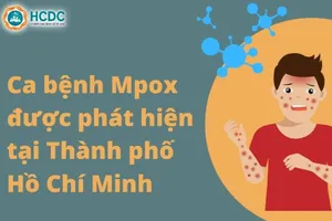 TP.HCM ghi nhận 2 trường hợp mắc bệnh đậu mùa khỉ