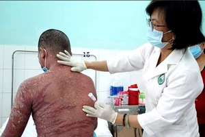 Đỏ da toàn thân vảy nến do dùng thuốc quảng cáo trên mạng