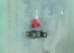 Gắp thanh kim loại khỏi thực quản trẻ 8 tháng tuổi