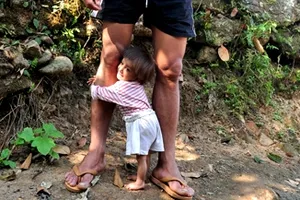 Hai bé tý hon chờ vào Sài Gòn khám bệnh