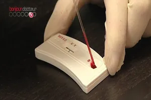 Pháp: Cho phép lưu hành sản phẩm tự xét nghiệm HIV