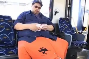 Người có bộ phận sinh dục nặng gần 60 kg qua đời