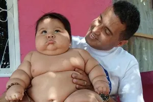 Bé 8 tháng có cân nặng của trẻ 6 tuổi