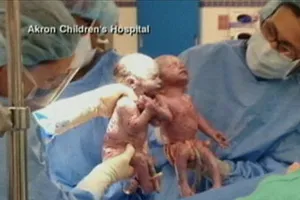 Nắm tay cùng chào đời