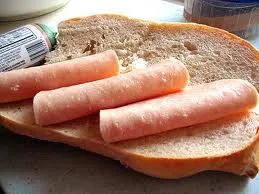 Hóc xúc xích, bé 8 tháng tuổi tử vong