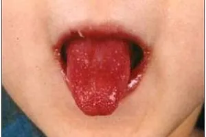 Gió độc từ Trung Quốc: Thủ phạm gây bệnh ở nhiều nước? 