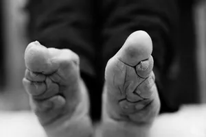 Bộ ảnh ấn tượng về tục bó chân của Trung Quốc