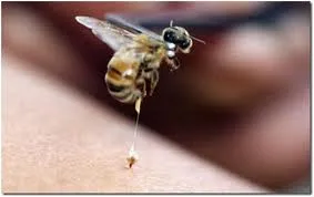 Nọc ong trong châm cứu bệnh Parkinson?