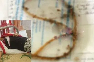 Bác sĩ bỏ quên gạc trong hốc xương má?