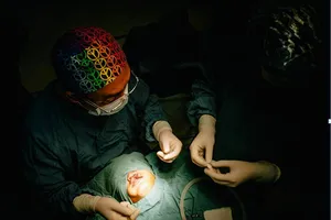 Phẫu thuật miễn phí dị tật khe hở môi, hàm ếch 