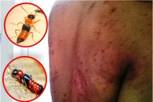 Kiến ba khoang ồ ạt 'tấn công' sinh viên 