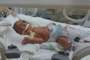 Mổ bắt con, cứu thai phụ bị tai nạn dập phổi