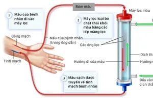 Quá trình chạy thận diễn ra như thế nào?