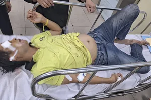 Bị chó rượt, hai vợ chồng bị té trọng thương