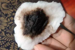 Sở Y tế vào cuộc vụ nước đục, có vị lợ ở Đà Nẵng