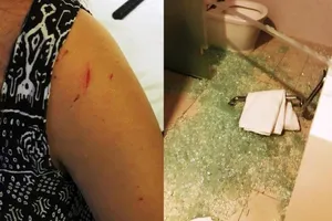 Kính trong khách sạn vỡ làm khách nữ bị thương