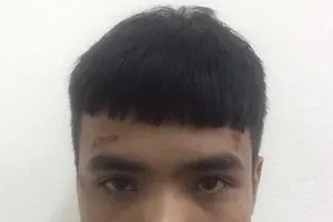 Cô gái cho tên cướp văng khỏi xe máy bằng cú giật chỏ