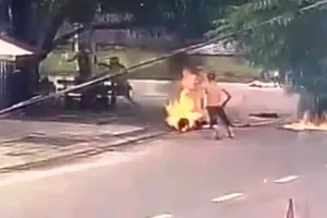 Cô gái bị tưới xăng đốt vì đánh ghen bị bỏng 30%