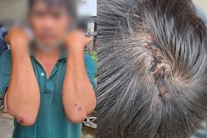 Nhóm trộm gà đánh chủ nhà bất tỉnh