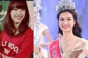 Tân hoa hậu bị tố phẫu thuật thẩm mỹ răng, ban tổ chức nói gì?