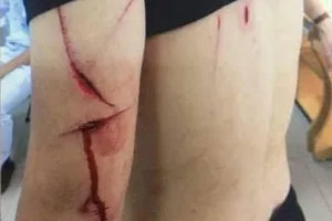 Hàng chục côn đồ ở Hải Phòng chém trọng thương 1 người