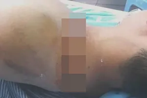 Giang hồ Hải Phòng nổ súng, chém người trong quán ăn