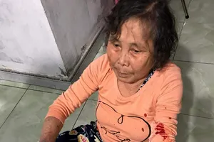 Nhắc nhở hàng xóm mở nhạc to, cụ bà 83 tuổi bị đánh nhập viện