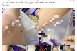 Trắng kiểu... lột da như rắn