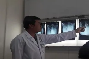 Bị ong đốt, 1 nữ sinh suýt tử vong