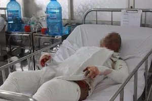 Cô gái bị bỏng nhảy từ lầu 1 xuống đất đang nguy kịch