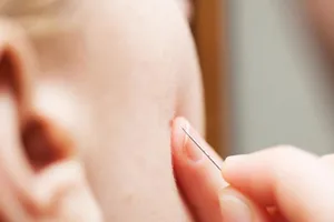 Cô gái suýt chết vì... nặn mụn